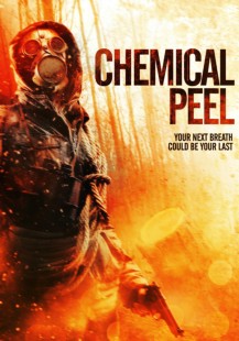 Chemical Peel